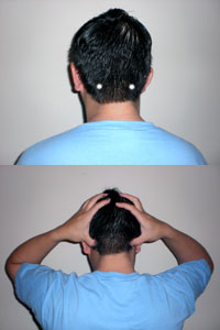 Acupressure Point GB20