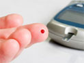 Physical Therapy for the Treatment of Diabetes