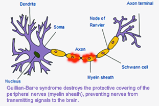 Barre (exercise) - Wikipedia