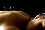 Acupuncture as an Adjunct to Physical Therapy