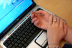 Carpal Tunnel Syndrome