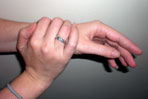 De Quervain's Tenosynovitis