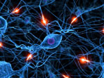 Reflex Sympathetic Dystrophy - image courtesy of Advanced Pain Management
