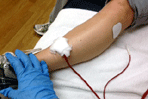 The use of Electrical Stimulation in Physical Therapy Wound Care 