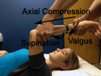 Posterolateral Rotatory Instability of the Elbow