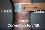 A Review of Patellar Taping for Patellofemoral Pain Syndrome