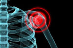 Physical Therapy Implications For Treating Post Surgical Shoulder Patients