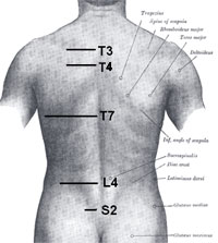 Thoracic spine syndrome  causes, symptome & treatment